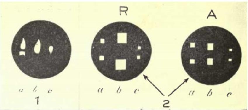 Рисунок	9.	Схема	изображений	Пуркинье.№1	—	Изображение	свечи: а,	на	роговице;	b,	на	передней	поверхности	хрусталика;	с,	на	задней поверхности	хрусталика.№2	—	Изображения	лучей	света, проходящих	сквозь	прямоугольные	отверстия	в	непрозрачной пластине,	когда	глаз	находится	в	покое	(R)	и	во	время	аккомодации (А):	а,	на	роговице;	b,	на	передней	поверхности	хрусталика;	с, на	задней	поверхности	хрусталика	(согласно	Гельмгольцу). Заметьте,	что	в	№2,	А,	центральные	изображения	меньше	и	доходят друг	до	друга	—	изменение,	которое,	если	оно	на	самом	деле имело	бы	место,	говорило	бы	об	увеличении	кривизны	передней поверхности	хрусталика	во	время	аккомодации.