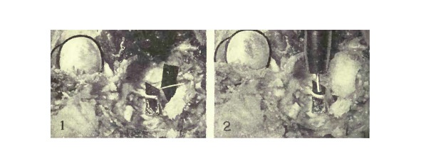 Рисунок 22. Эксперимент на примере глаза кошки, демонстрирующий, что четвёртый нерв, который поддерживает только верхнюю косую мышцу, является точно таким же нервом аккомодации, как и третий, и что верхняя косая мышца, которая его поддерживает — мышца аккомодации.№1 — Оба нерва были выведены наружу возле их основания в головном мозге, и полоска чёрной бумаги была вложена позади каждой для того, чтобы изображение можно было увидеть. Четвёртый нерв — это тот, что поменьше. Верхняя косая мышца была перемещена путём подгибания, так как эта мышца всегда недоразвита у кошек и пока её натяжение не усиливают, аккомодация у этих животных не воспроизводится. Стимуляция одного или обоих нервов импульсным током способствовала возникновению аккомодации. №2 — Когда четвёртый нерв был покрыт ватой, пропитанной нормальным физиологическим раствором, применение импульсного тока производило аккомодацию. Когда вата была пропитана в однопроцентном растворе атропина сульфата в нормальном физиологическом растворе, тогда аккомодацию не удавалось воспроизвести, но стимуляция третьего нерва воспроизводила её.