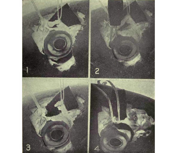 Рисунок 14. Демонстрация, на примере глаза карпа, того, что верхняя косая мышца играет значимую роль в процессе аккомодации.№1 — Верхняя косая мышца приподнята от глазного яблока с помощью двух нитей и ретиноскоп показывает отсутствие аномалий рефракции. №2 — Стимуляция электрическим током приводит к возникновению аккомодации, как определил ретиноскоп. №3 — Мышца была разрезана. Стимуляцией глазного яблока электрическим током не удалось воспроизвести аккомодацию. №4 — Разрезанная мышца была вновь соединена путём скрепления нитей. Аккомодация возникает, как и прежде, в результате стимуляции электрическим током.